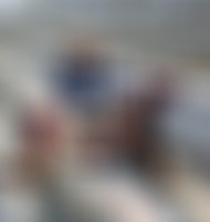 Peg